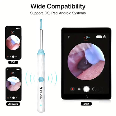 Earwax cleaner tool kit with 1080P camera WIFI & LED Light